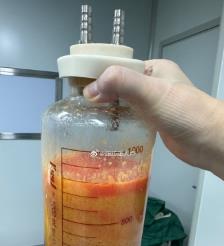 濮阳水动力吸脂手术要做多久？